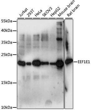 Anti-EEF1E1 Antibody