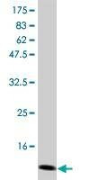 Anti-CSF2 Antibody