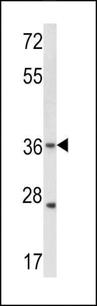 Anti-Connexin 31 (C-term) Antibody