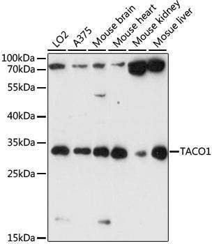 Anti-TACO1 Antibody