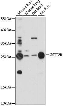 Anti-GSTT2B Antibody