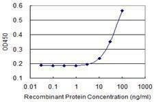 Anti-CSF2RA Antibody