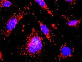 Anti-CSF2RA Antibody