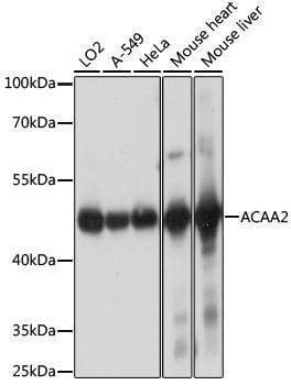 Anti-ACAA2 Antibody