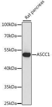 Anti-ASCC1 Antibody