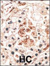 Anti-Hippocalcin (N-term) Antibody
