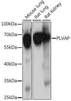 Anti-PLVAP Antibody