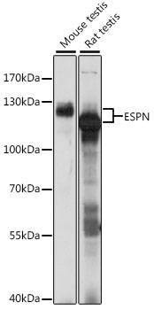 Anti-ESPN Antibody