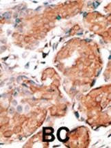 Anti-GCAP1 (C-term) Antibody