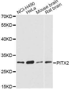 Anti-PITX2 Antibody