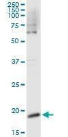 Anti-CSF3 Antibody
