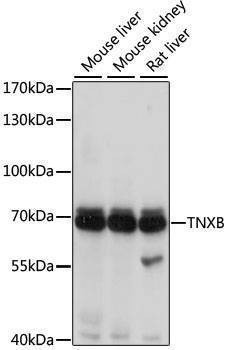 Anti-TNXB Antibody