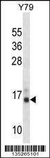 Anti-PFN2 (C-term) Antibody