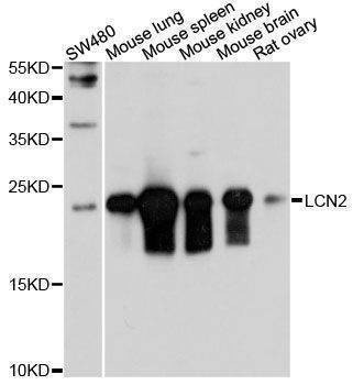 Anti-LCN2 Antibody