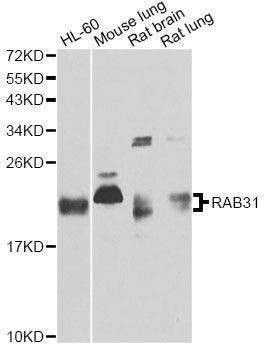 Anti-RAB31 Antibody