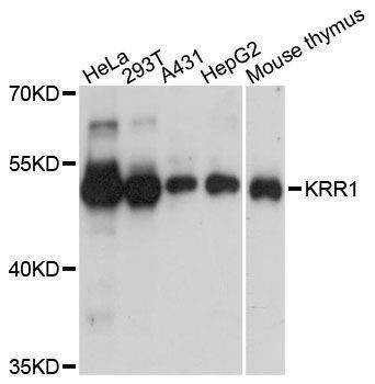 Anti-KRR1 Antibody