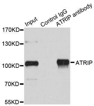 Anti-ATRIP Antibody