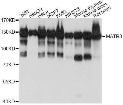 Anti-MATR3 Antibody