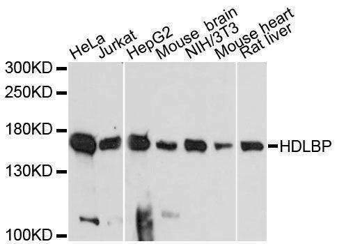 Anti-HDLBP Antibody