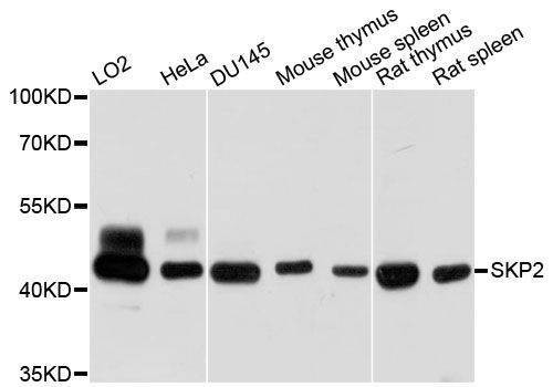 Anti-SKP2 Antibody