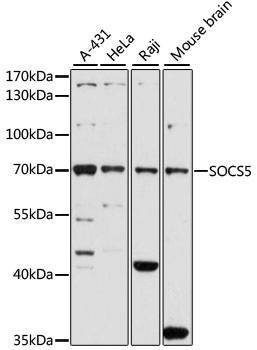 Anti-SOCS5 Antibody