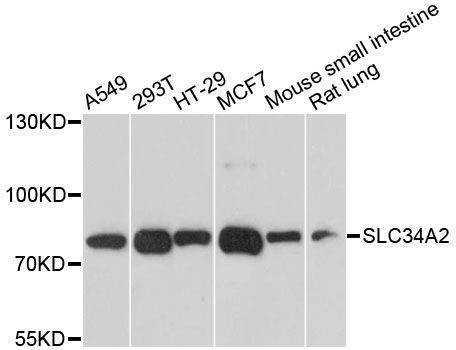 Anti-SLC34A2 Antibody