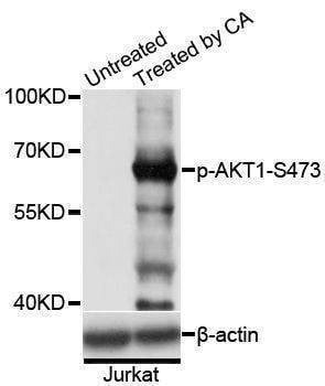 Anti-AKT1 Antibody