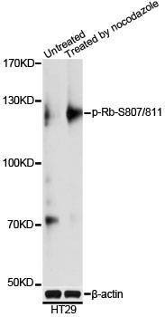 Anti-RB1 Antibody