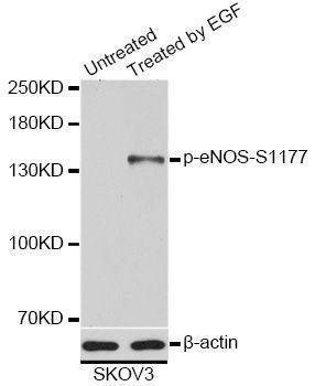 Anti-NOS3 Antibody
