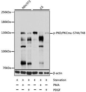 Anti-PRKD1 Antibody