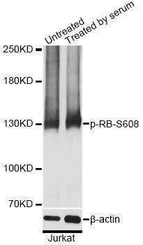 Anti-RB1 Antibody