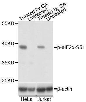 Anti-EIF2S1 Antibody