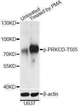 Anti-PRKCD Antibody