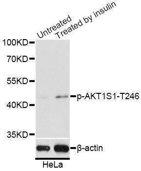 Anti-AKT1S1 Antibody