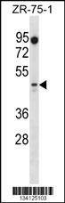 Anti-PBX2 (Center) Antibody