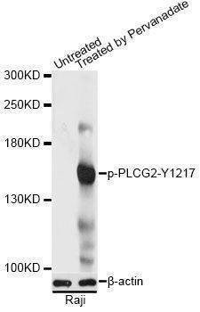 Anti-PLCG2 Antibody