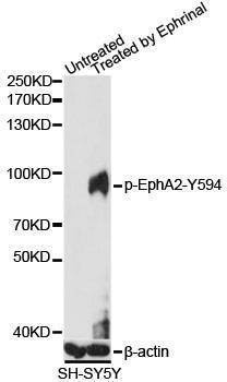 Anti-EPHA2 Antibody