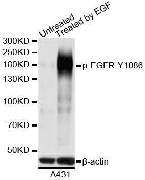 Anti-EGFR Antibody