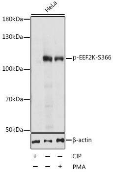 Anti-EEF2K Antibody
