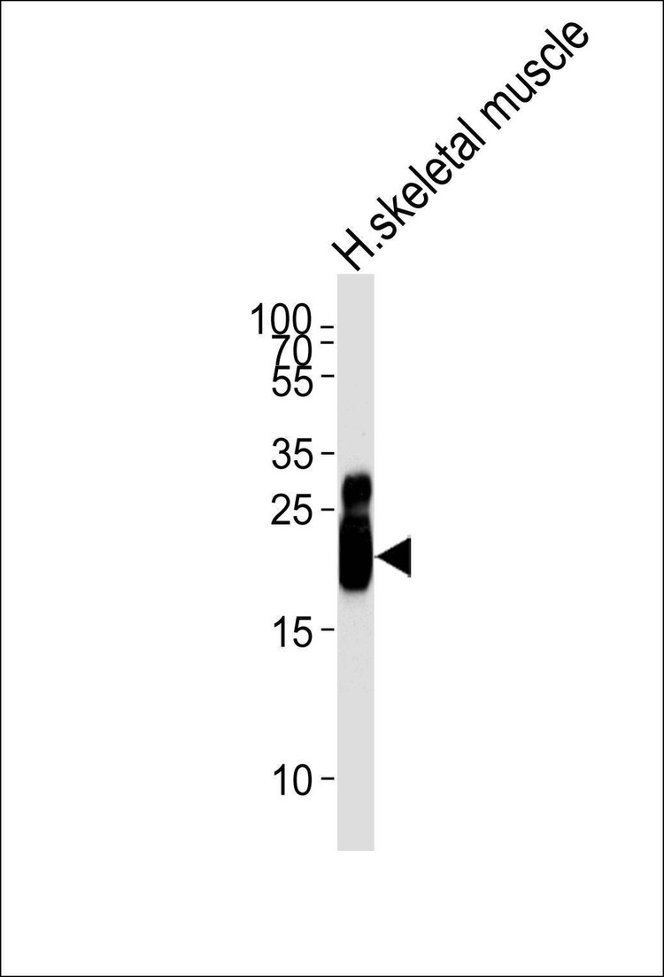 Anti-TNNI2 (N-term) Antibody