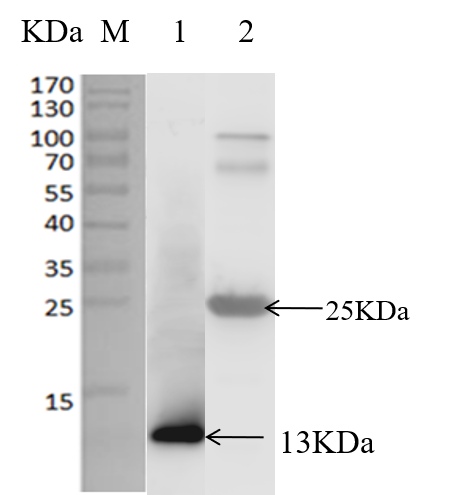 Anti-S100A8 Antibody