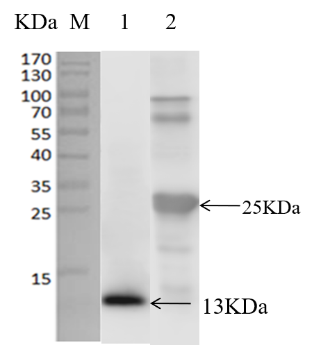 Anti-S100A8 Antibody