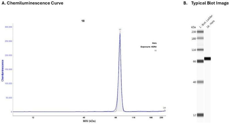 Cell Lysate: Hela: 0.2 mg/ml | Secondary Ab: Mouse | Exposure: HDR | Expected MW (kDa): 67.8