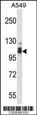 Anti-SMEK2 (C-term) Antibody