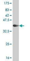 Anti-CSNK2A1 Antibody