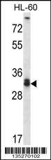 Anti-STX6 (Center) Antibody