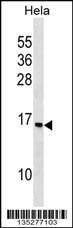 Anti-RPS14 (C-term) Antibody