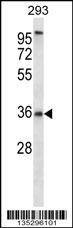 Anti-P2RY6 (C-term) Antibody