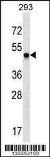 Anti-SNX17 (N-term) Antibody