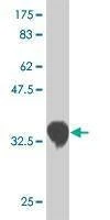 Anti-CSRP3 Antibody